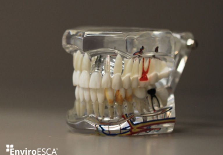 XPS surface analysis of human tooth samples with EnviroESCA